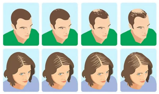 Who Uses Hair Building Fiber?