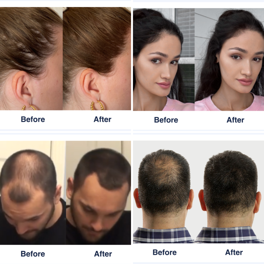 Hair Growth &amp; Volume Kit - KeraFiber UK
